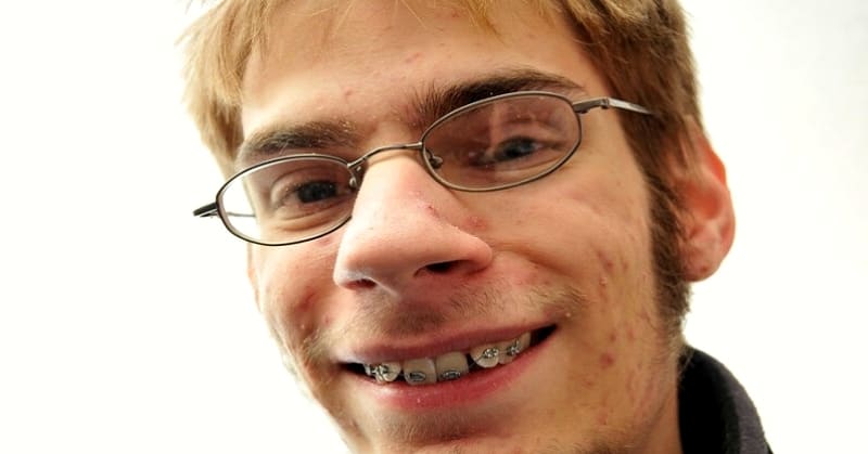 ugly nerdy man with braces