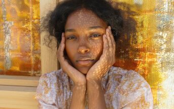 A person with medium-dark skin and curly hair rests their face in their hands, looking thoughtfully at the camera. Dappled sunlight creates patterned shadows on their face and background.